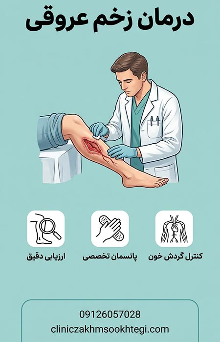 درمان زخم عروقی