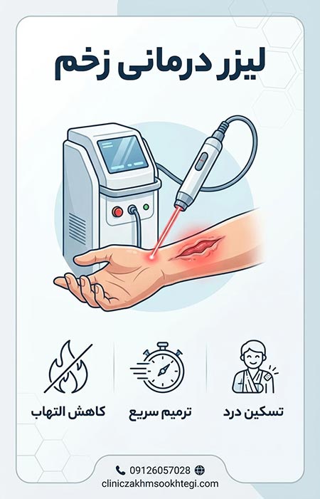 لیزر درمانی زخم