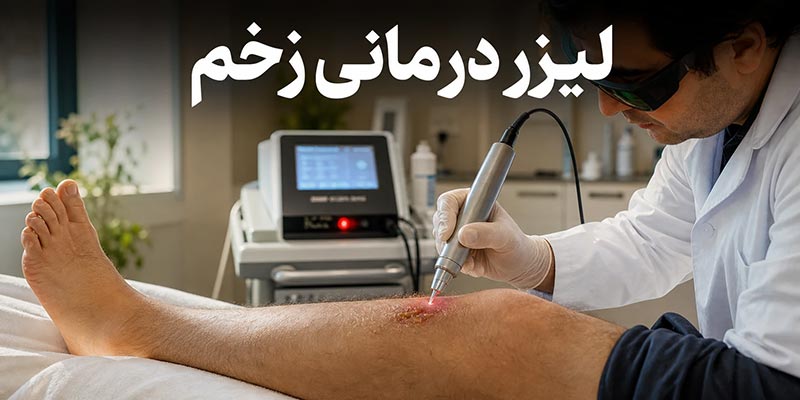 لیزر زخم