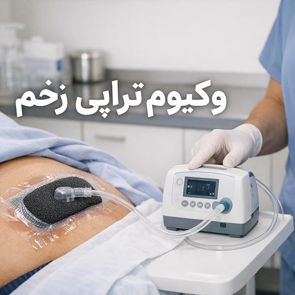 وکیوم--تراپی-زخم