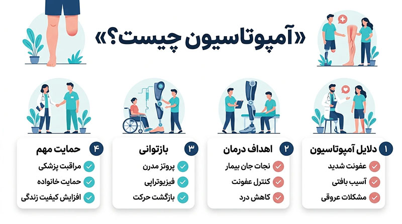 آمپوتاسیون یا آمپوته