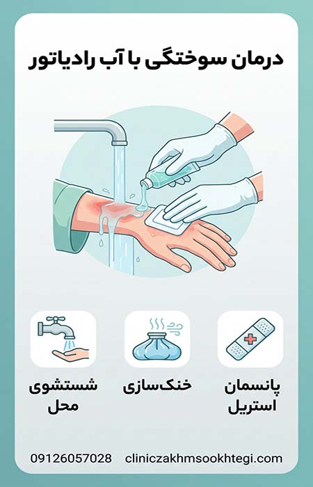 درمان سوختگی با آب رادیاتور
