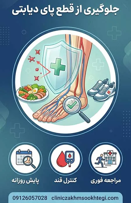جلوگیری از قطع پای دیابتی