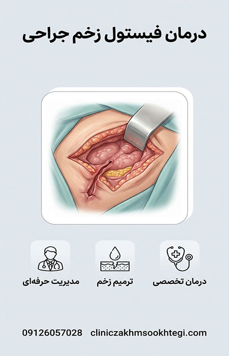 درمان فیستول زخم جراحی