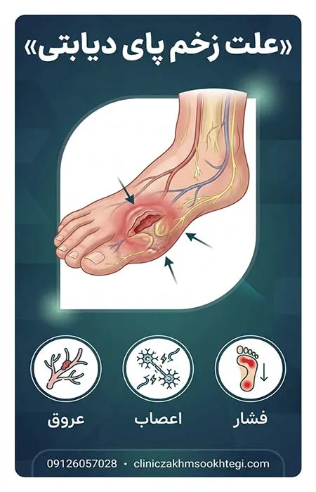 علت زخم پای دیابتی