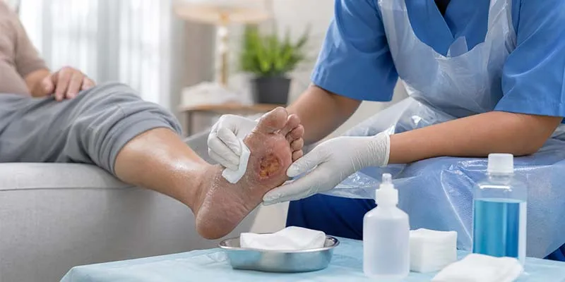 پانسمان-زخم-دیابتی